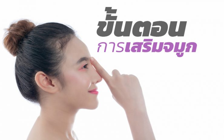 เสริมจมูก
