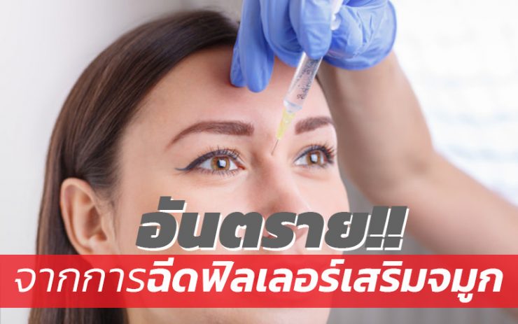 ฉีดฟิลเลอร์เสริมจมูก