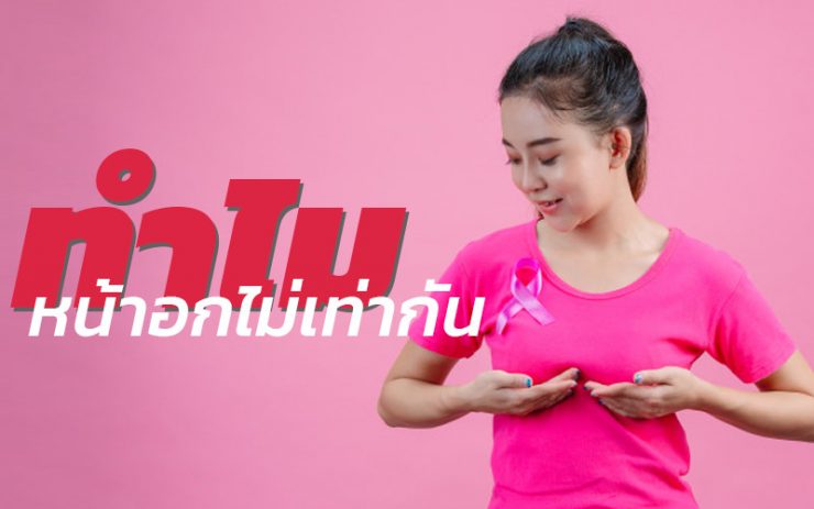 หน้าอกไม่เท่ากัน